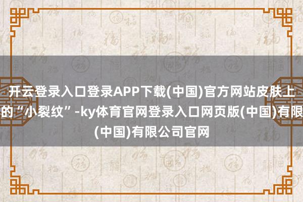 开云登录入口登录APP下载(中国)官方网站皮肤上全是细碎的“小裂纹”-ky体育官网登录入口网页版(中国)有限公司官网